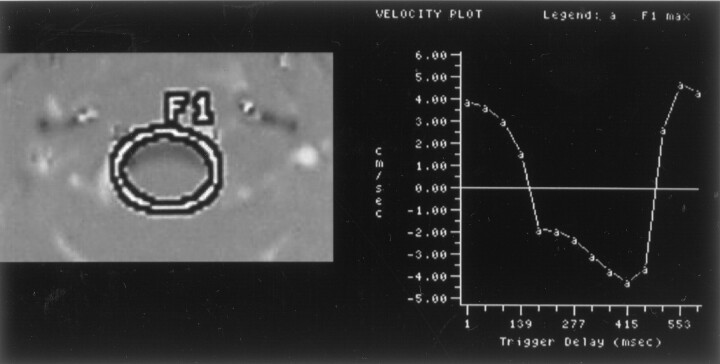 Fig 6.