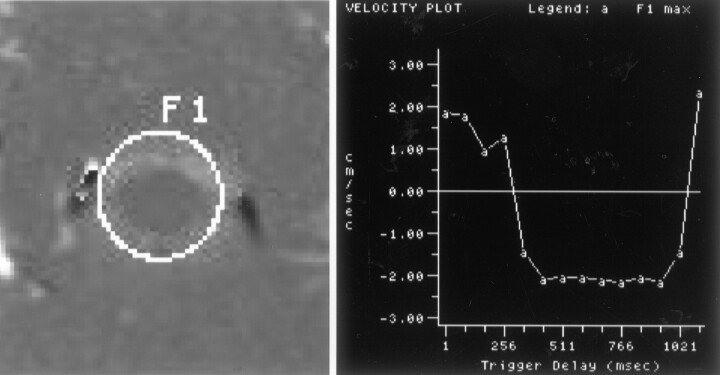 Fig 2.