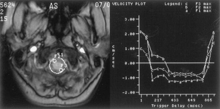 Fig 3.