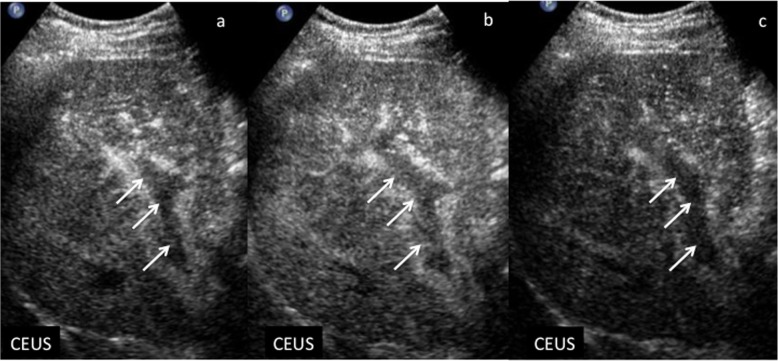 Fig. 13