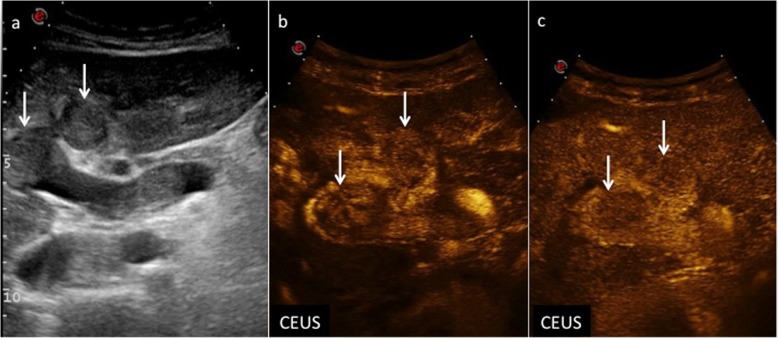 Fig. 12