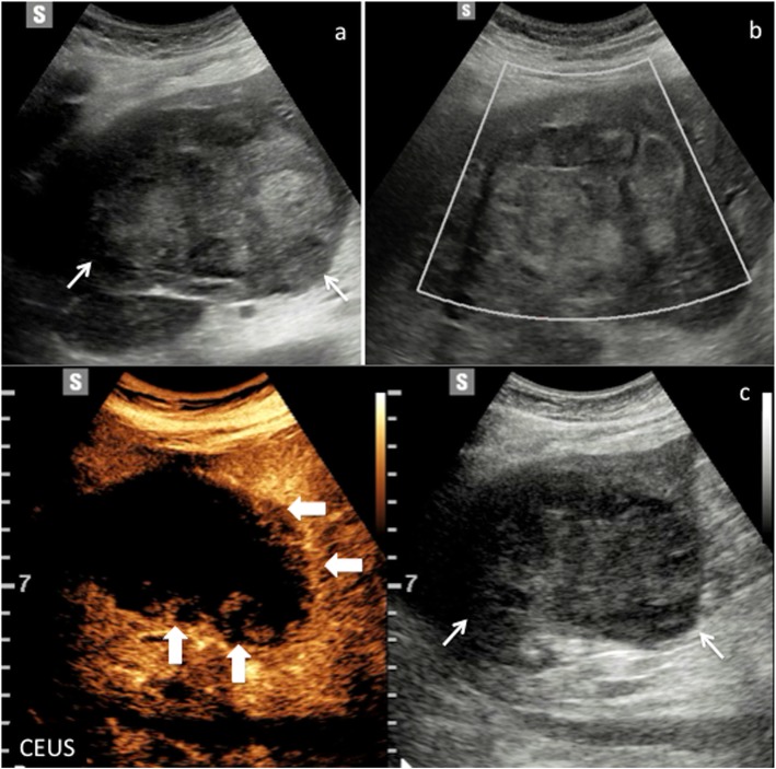 Fig. 10