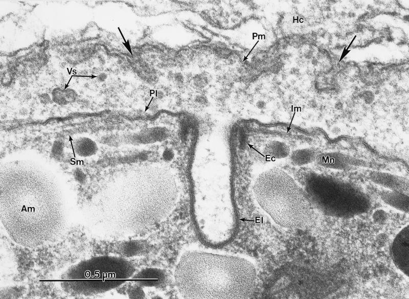 FIG. 14