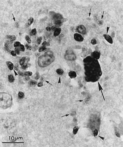 FIG. 31
