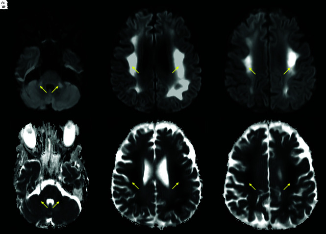 FIG 2.