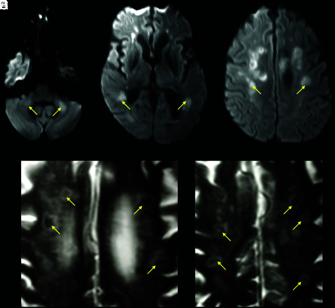 FIG 3.