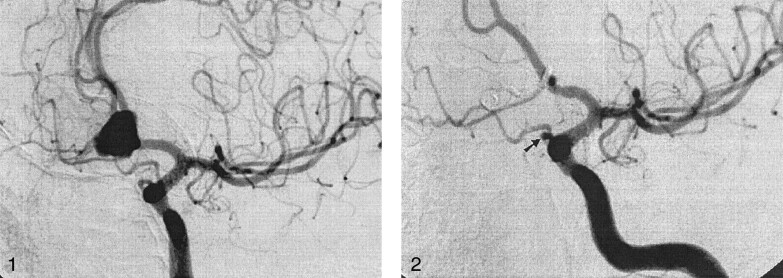 Fig 2.