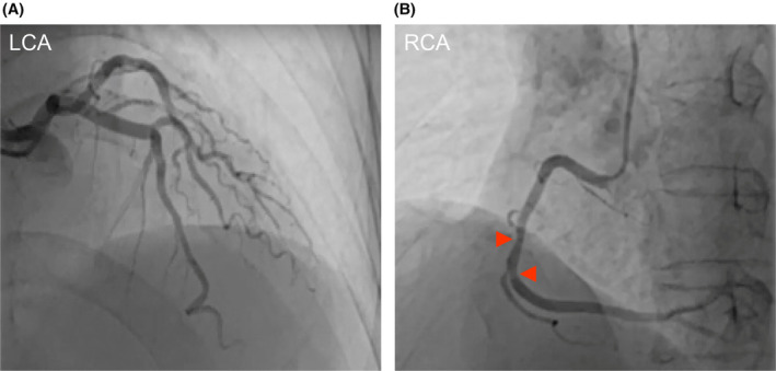 FIGURE 2