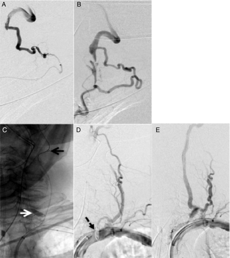 Figure 2