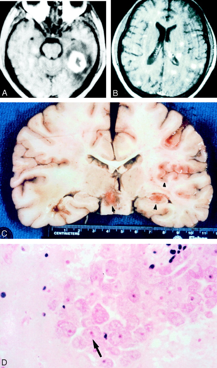 Fig 2.