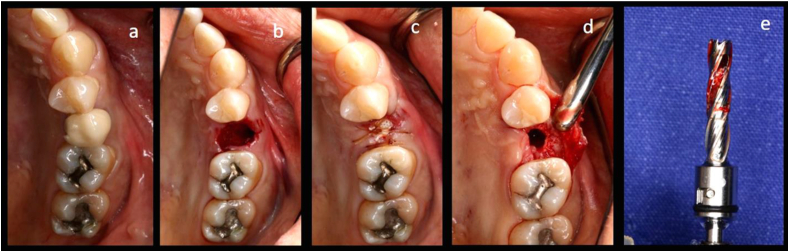 Figure 2