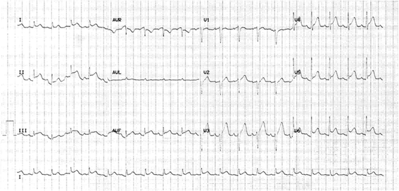 Fig. 1