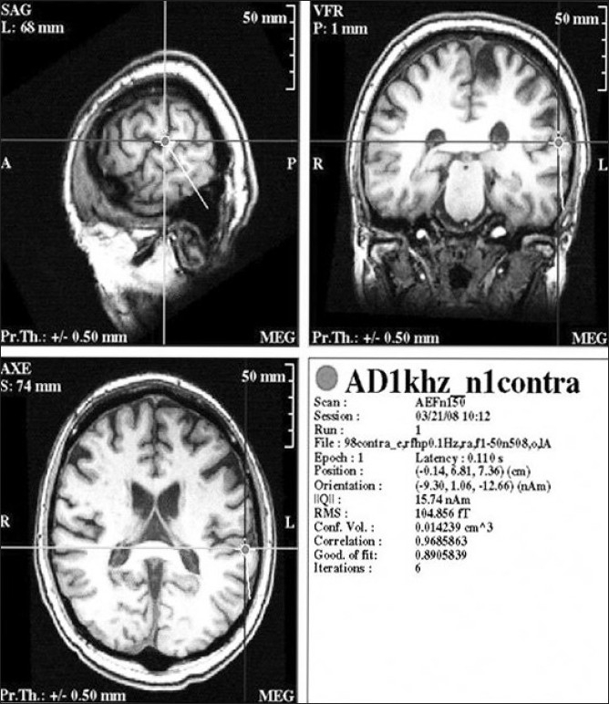 Figure 4