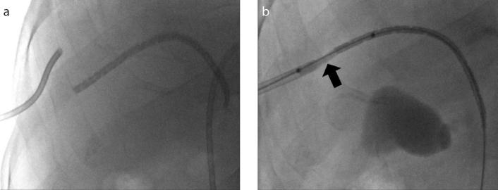 Figure 2. a, b