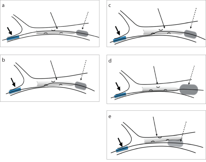 Figure 3. a–e