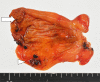 Fig.2