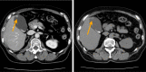 Fig.1