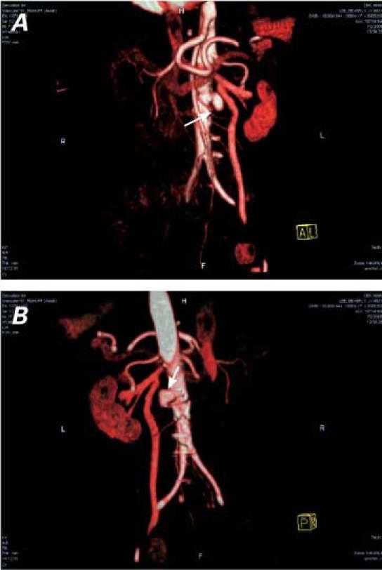 graphic file with name 17FF2.jpg