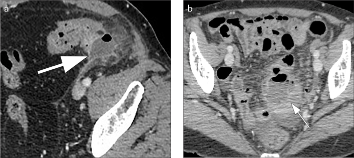 Figure 9. a, b