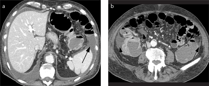 Figure 14. a, b