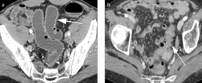 Figure 1. a, b