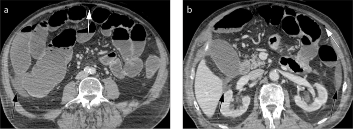 Figure 15. a, b