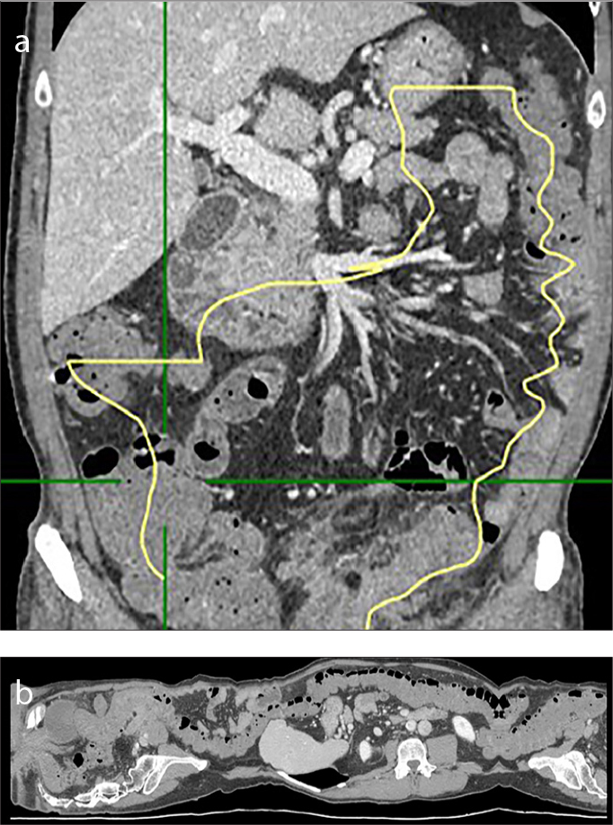 Figure 7. a, b