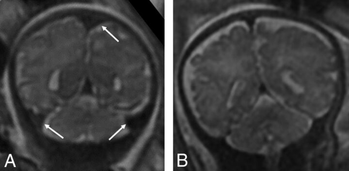 Fig 3.