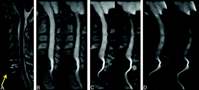 Fig 6.