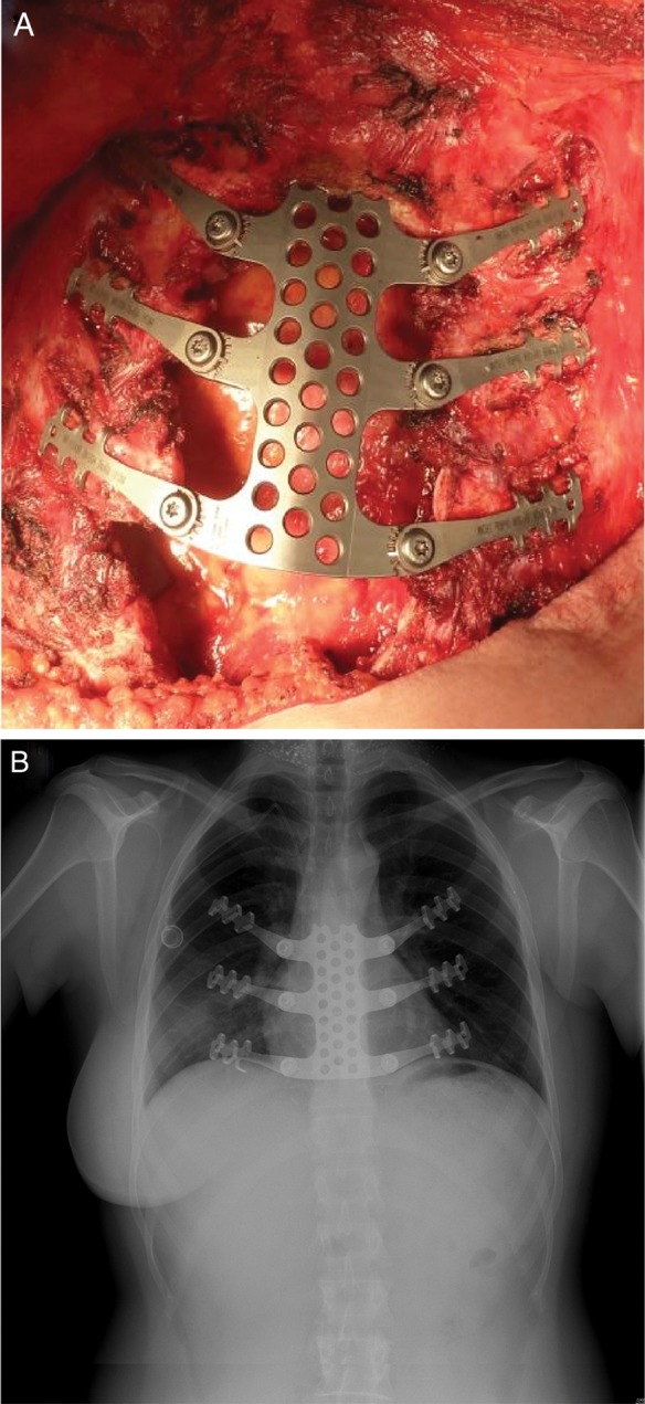 Figure 2: