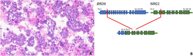 Figure 2