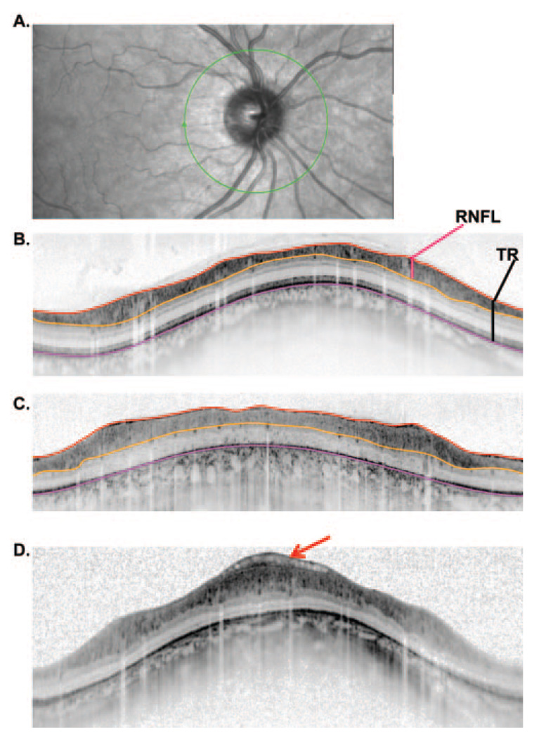 FIGURE 2