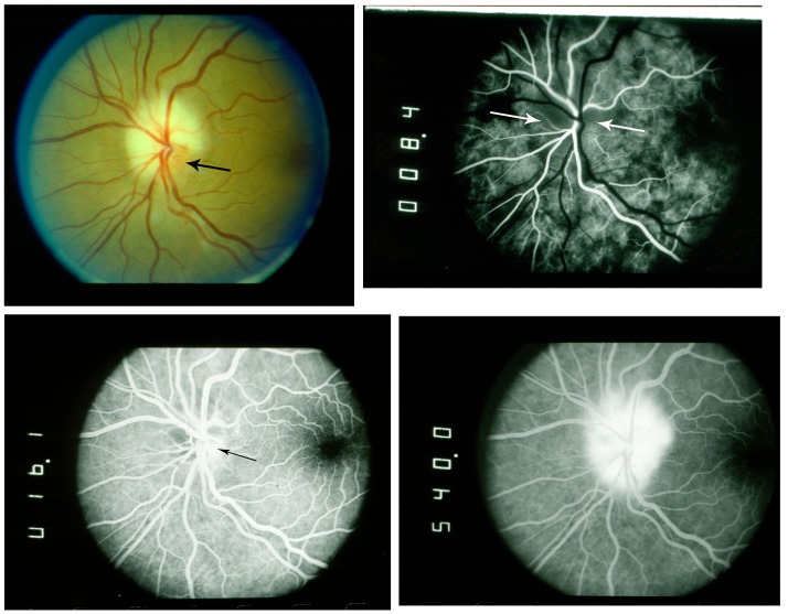 FIGURE 13