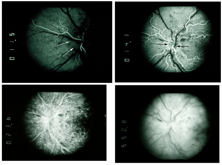 FIGURE 17