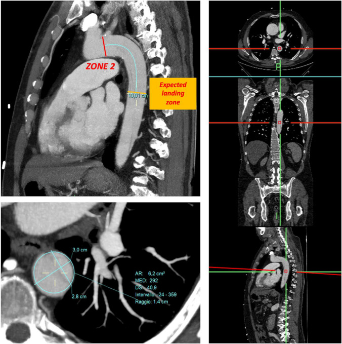 Fig. 1