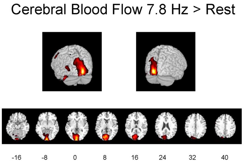 Figures 1A-1C