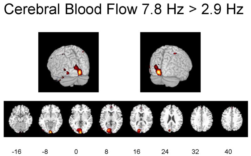 Figures 1A-1C