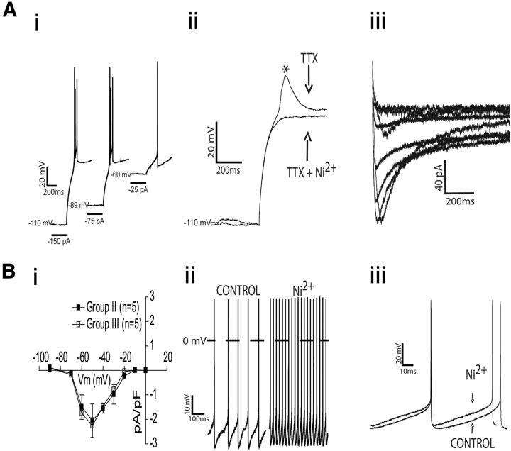 Figure 11.