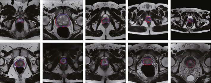 Figure 6