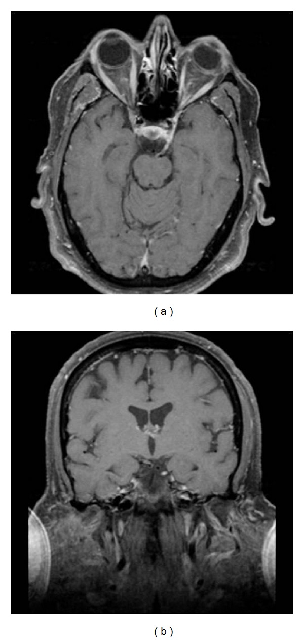 Figure 11