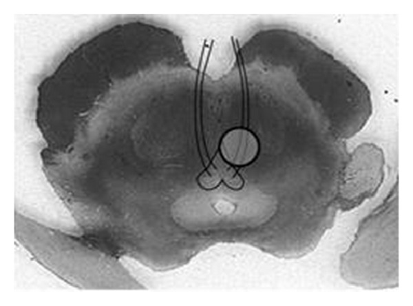 Figure 18