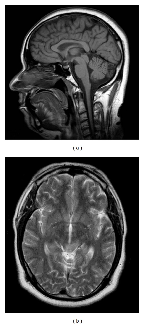 Figure 20