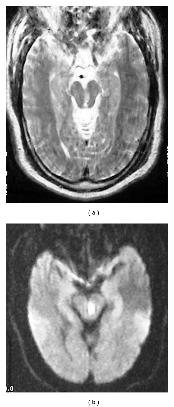 Figure 17