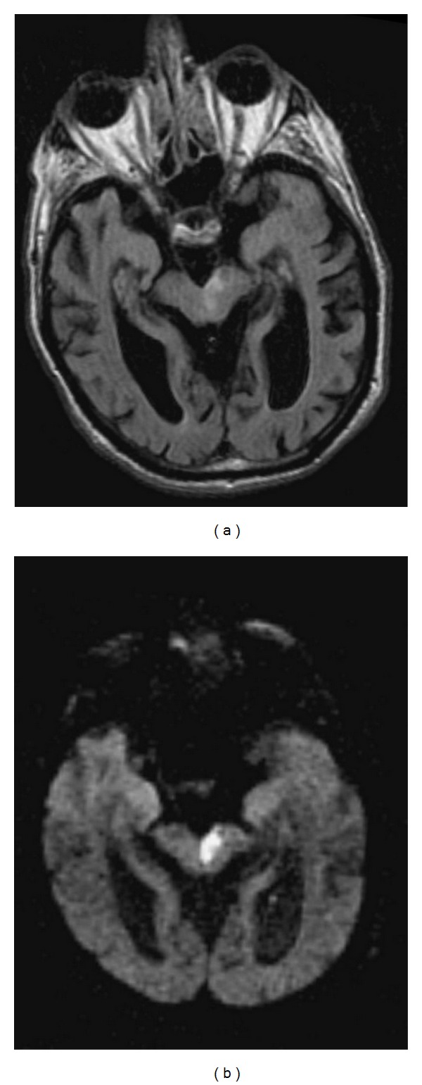 Figure 14