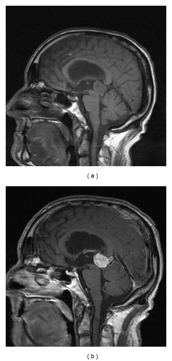 Figure 12