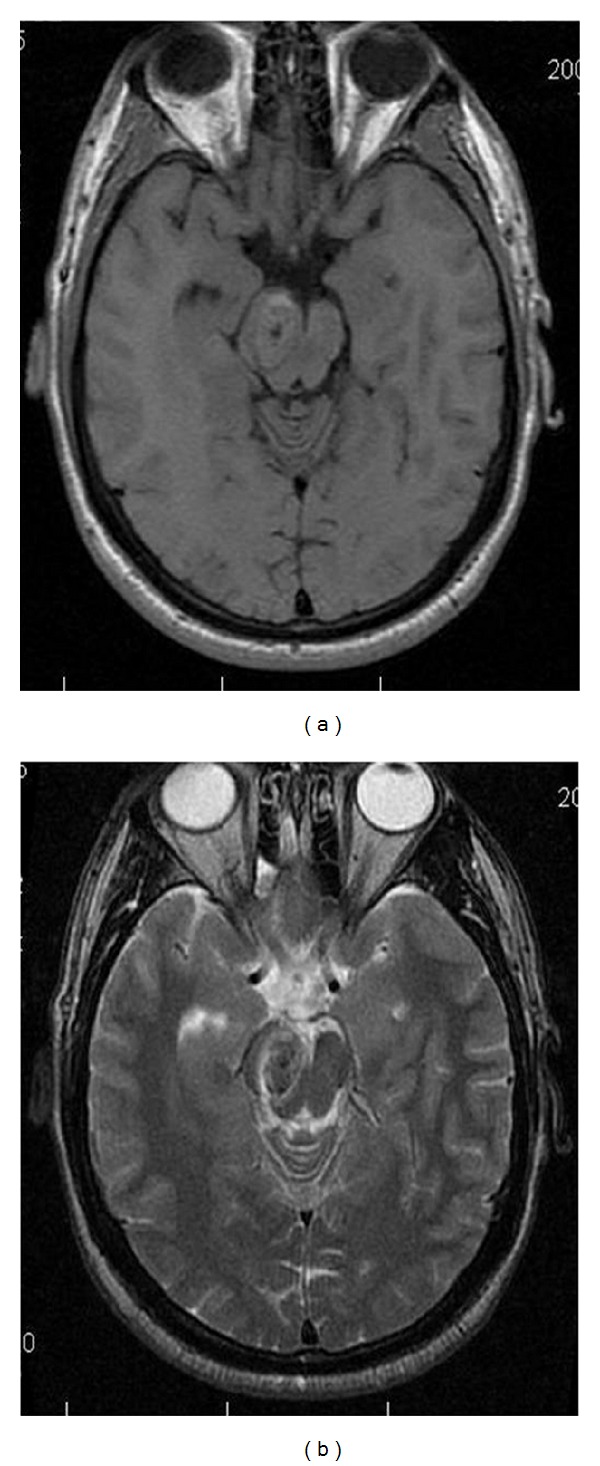 Figure 19