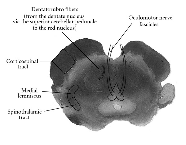 Figure 16