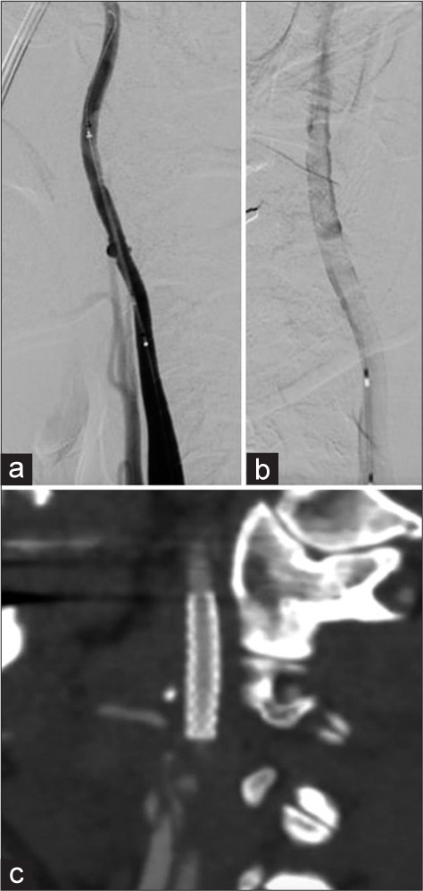 Figure 4: