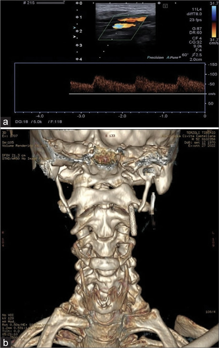 Figure 5: