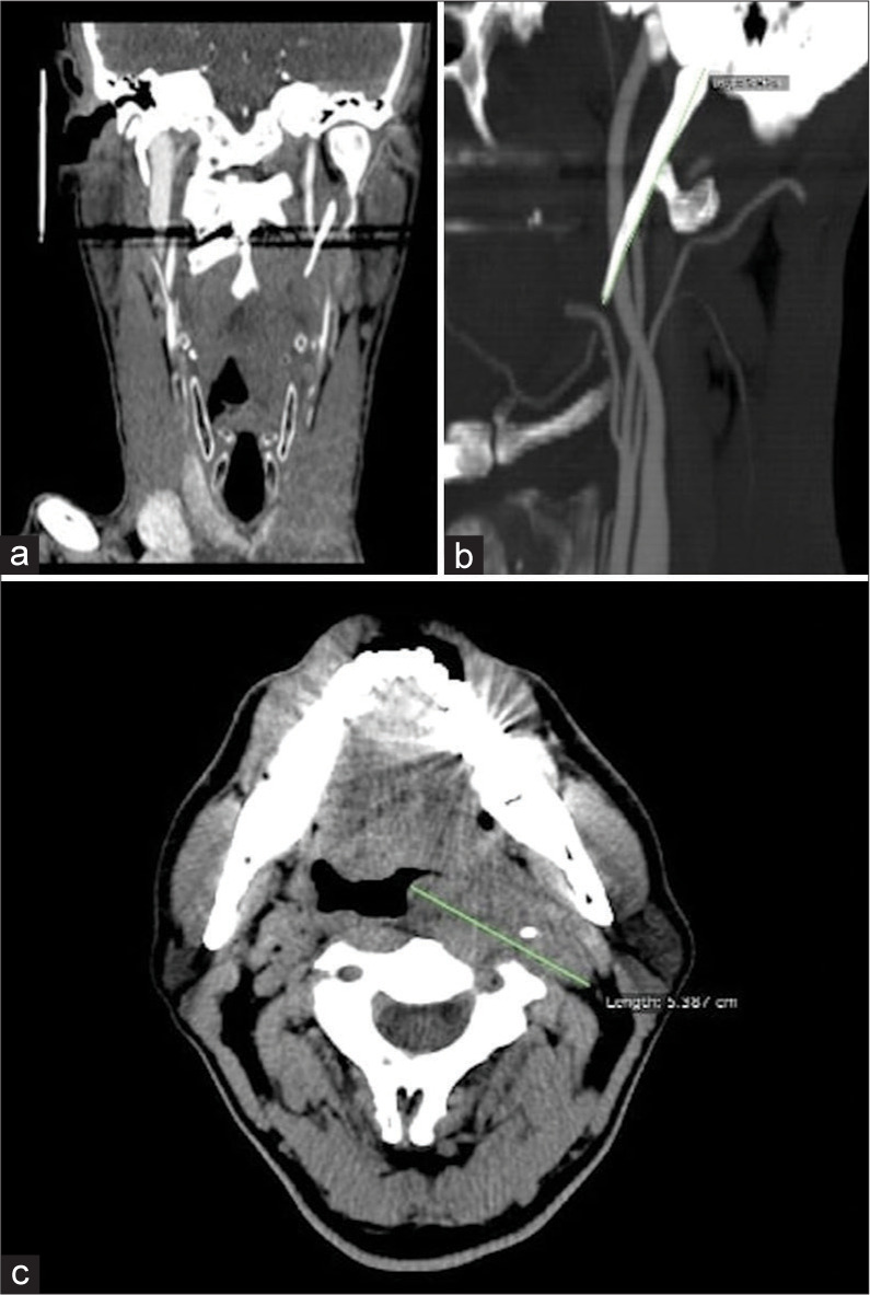 Figure 2: